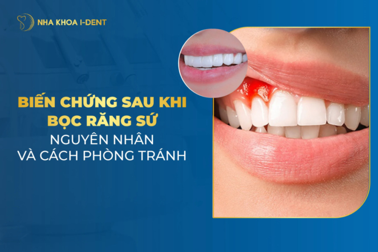 biến chứng sau khi bọc răng sứ