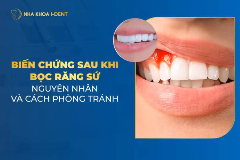 biến chứng sau khi bọc răng sứ