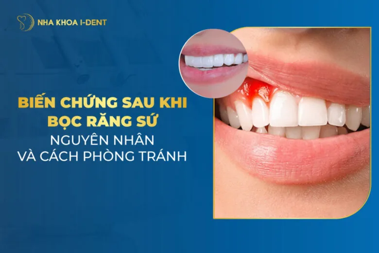biến chứng sau khi bọc răng sứ