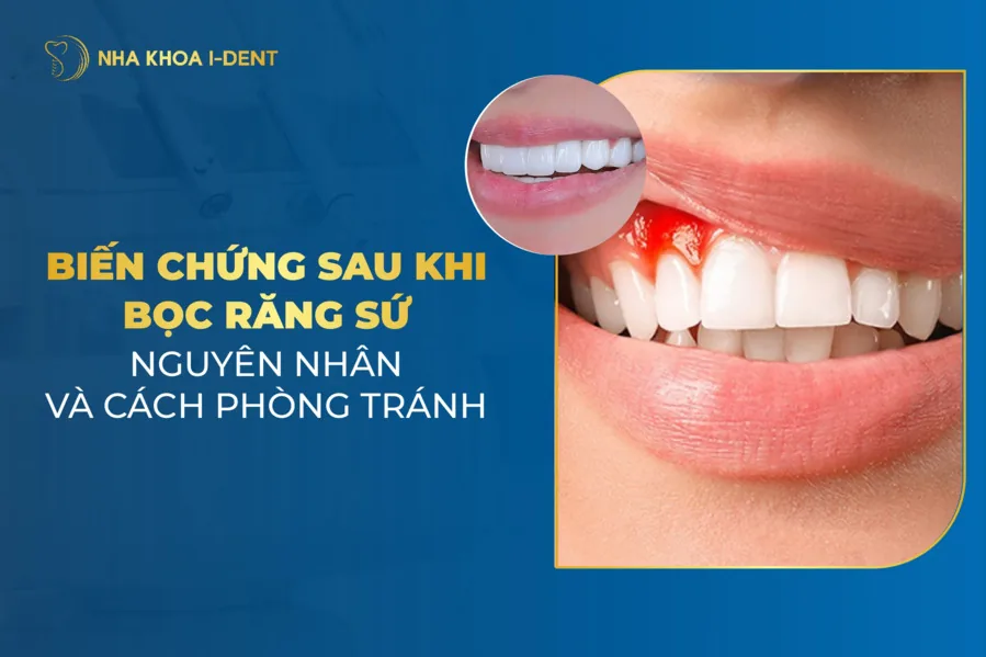 biến chứng sau khi bọc răng sứ