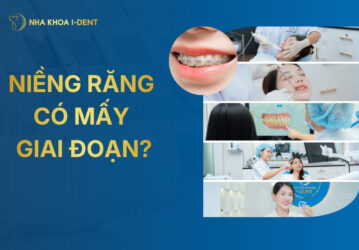 5 Giai Đoạn Niềng Răng Chi Tiết Từ Khám Đến Duy Trì