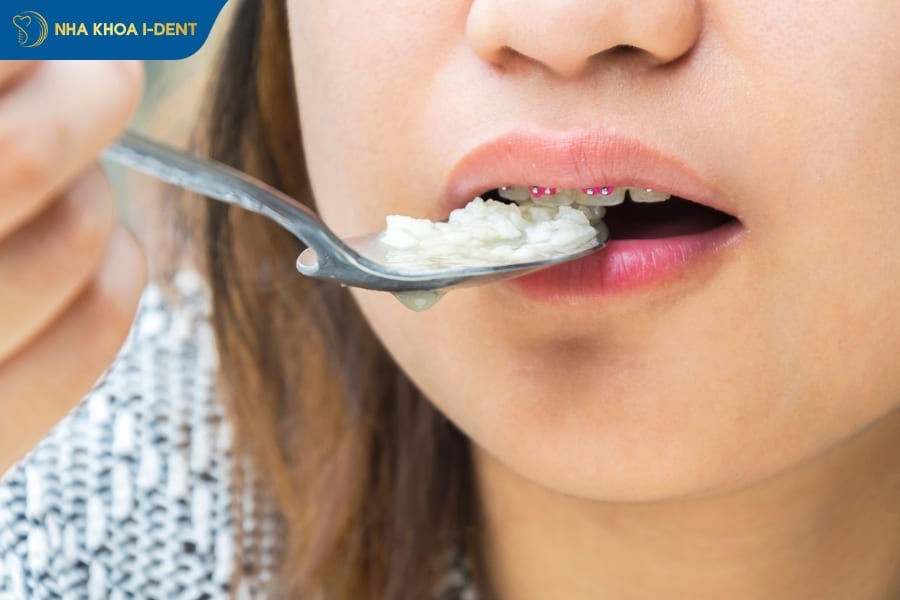 các lưu ý khi niềng răng