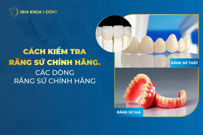 Top 3 cách kiểm tra răng sứ chính hãng