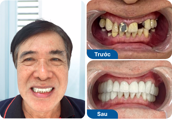 Chú Văn Vĩnh
