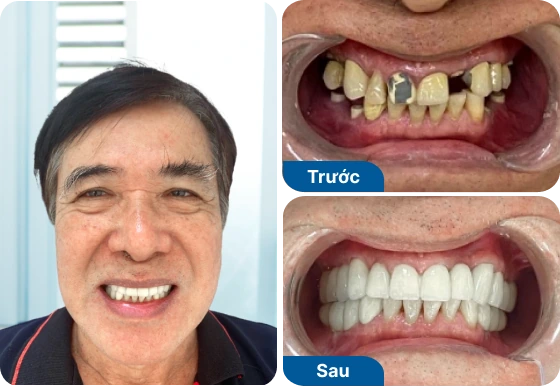 Chú Văn Vĩnh