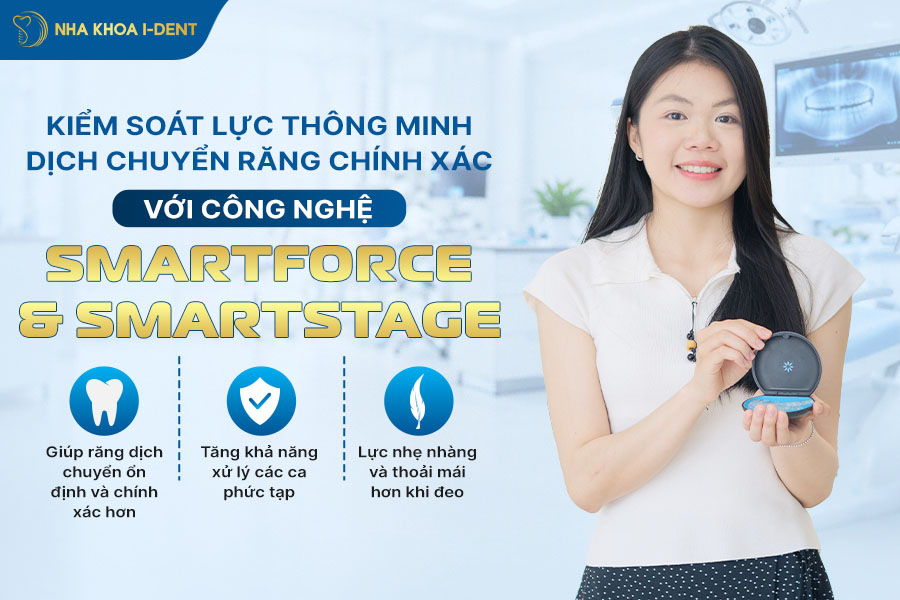 Giúp răng dịch chuyển ổn định và chính xác hơn với công nghệ SmartForce & SmartStage