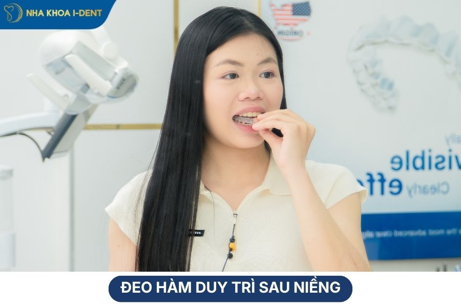 điều nên biết trong khi niềng răng