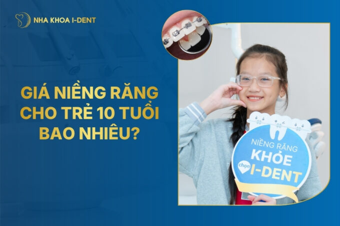 giá niềng răng cho trẻ 10 tuổi