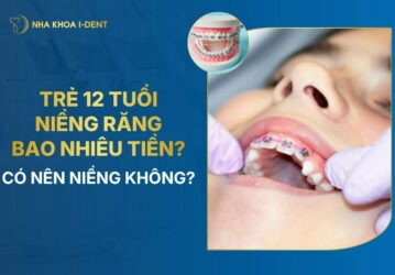 giá niềng răng cho trẻ 12 tuổi