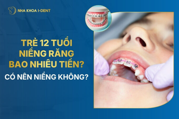 giá niềng răng cho trẻ 12 tuổi