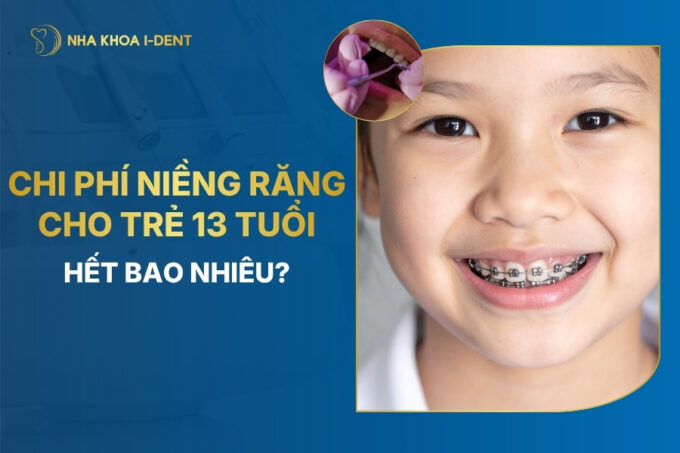 giá niềng răng cho trẻ 13 tuổi