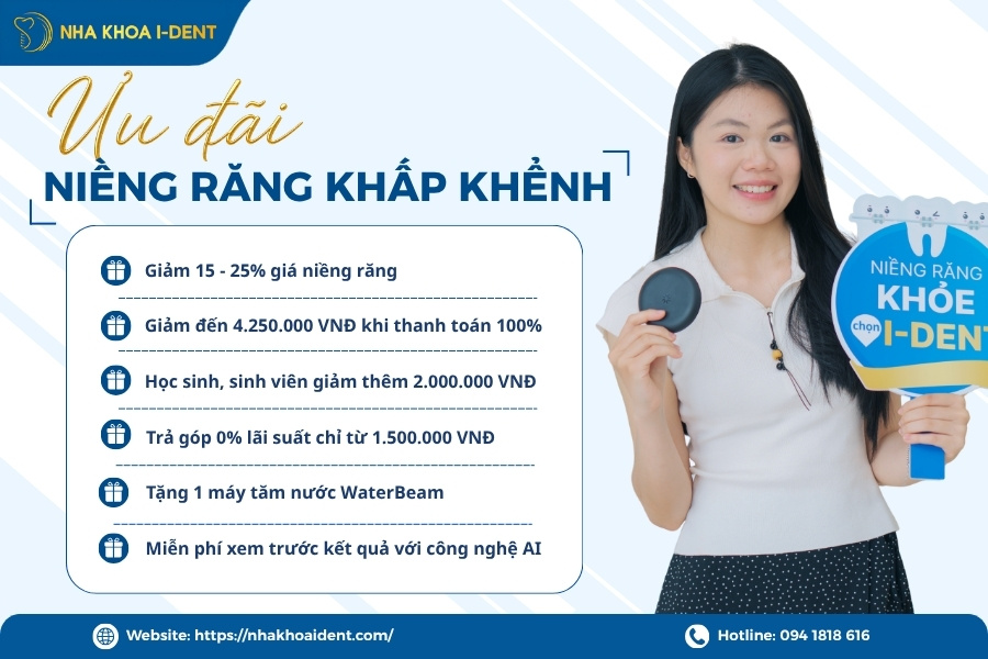 giá niềng răng khấp khểnh