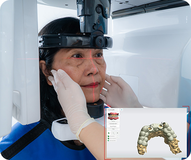 Nha khoa I-Dent ứng dụng công nghệ cấy ghép implant 3D.