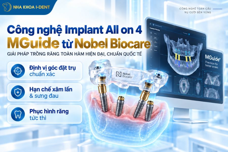 implant all on 4