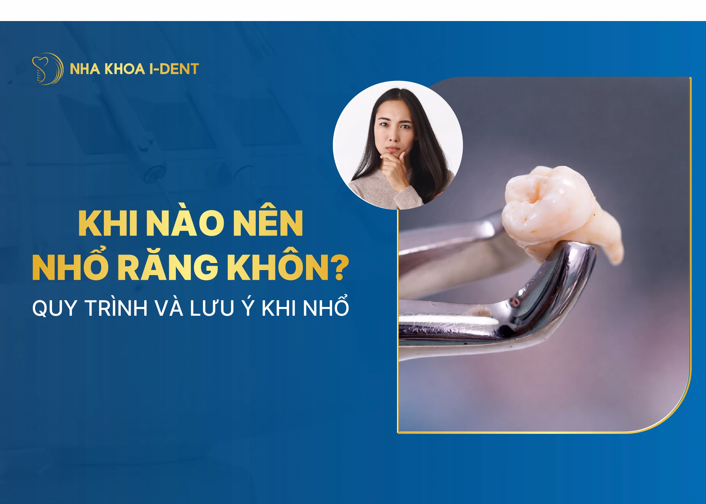 khi nào nên nhổ răng khôn