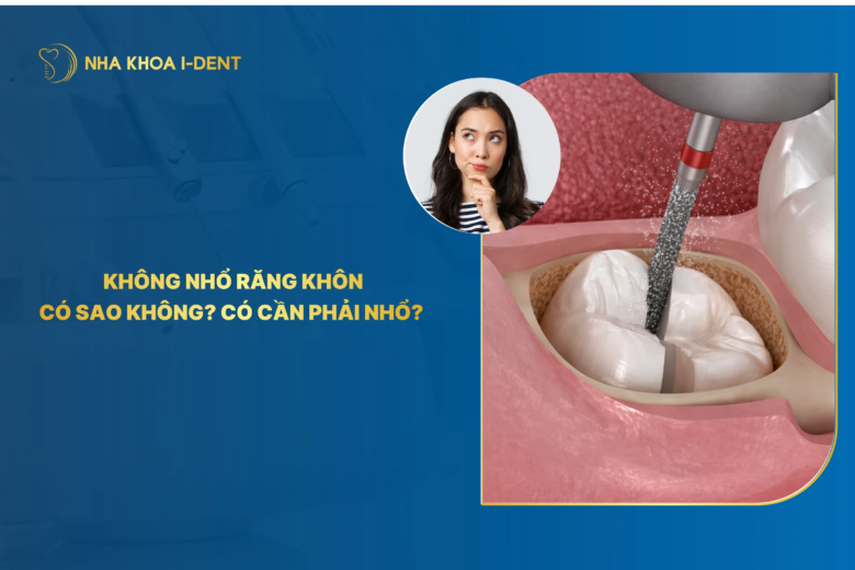 Không nhổ răng khôn có sao không? Có cần phải nhổ? 