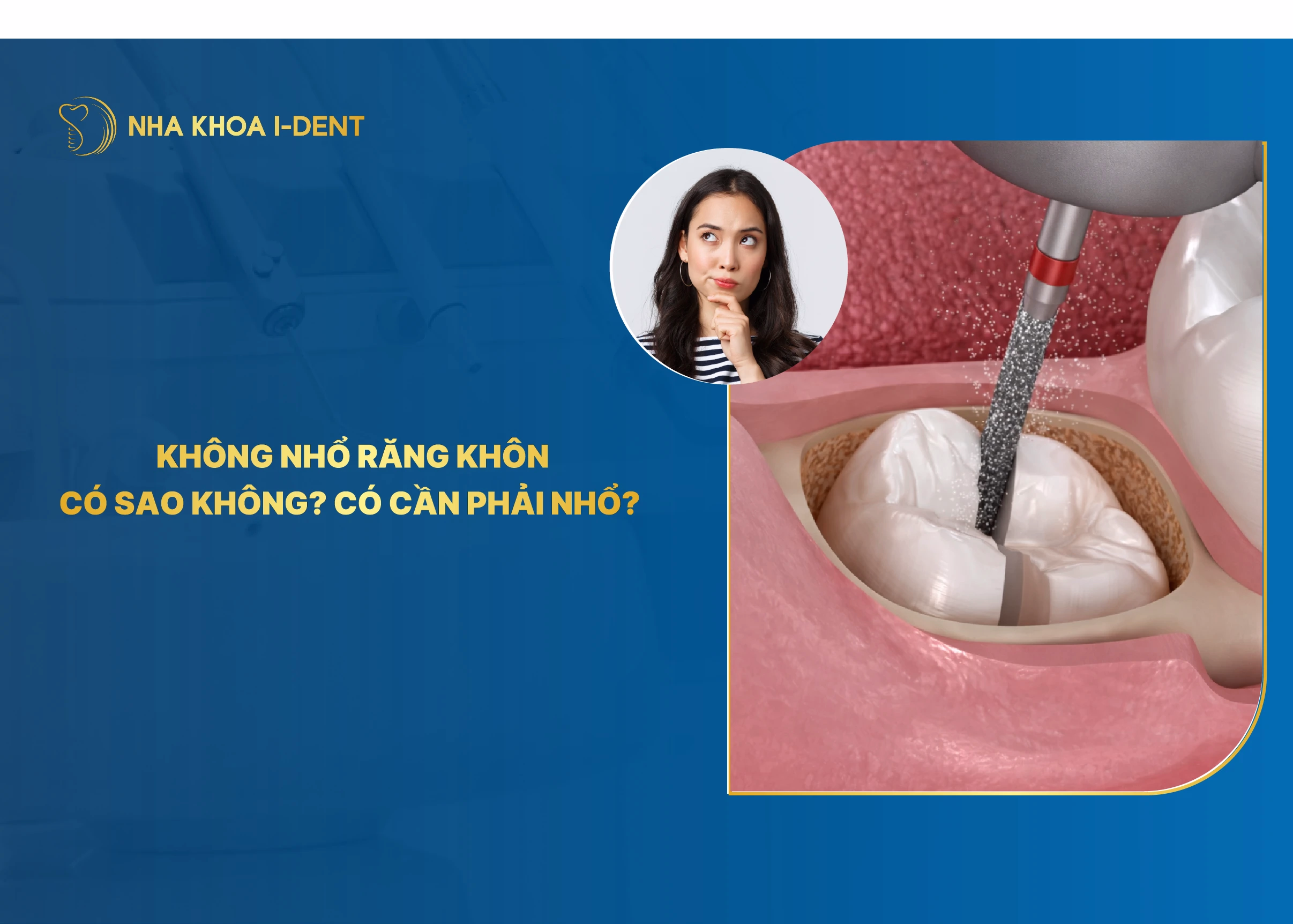 không nhổ răng khôn có sao không