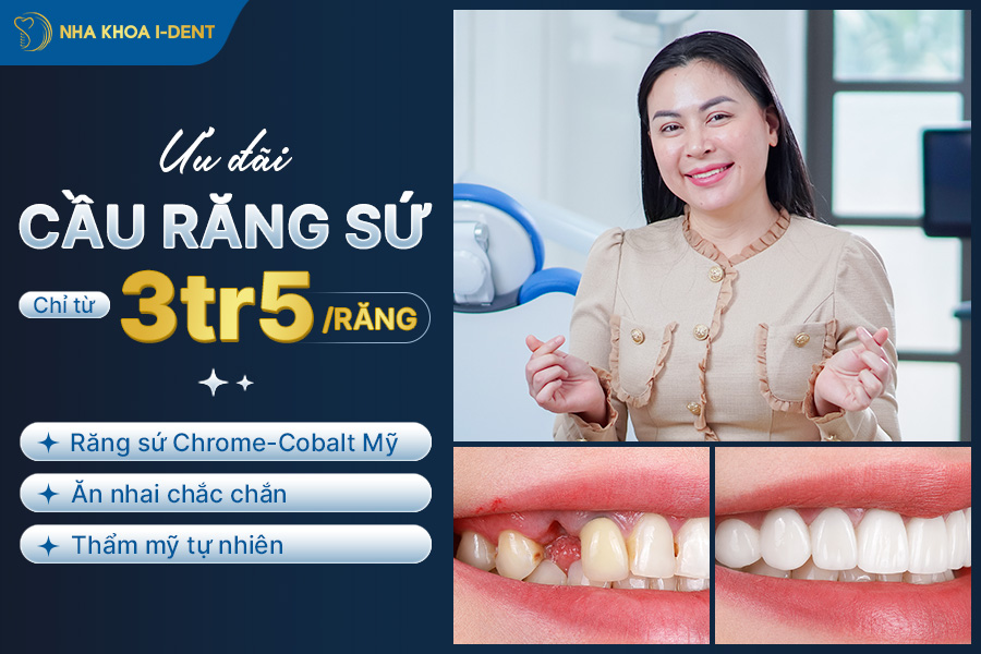làm cầu răng sứ giá bao nhiêu