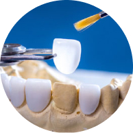 Miếng dán sứ Veneer Lisi Press.