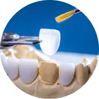 Miếng dán sứ Veneer Lisi Press.