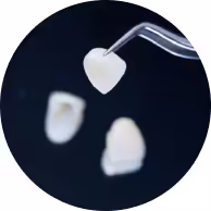 Miếng dán sứ Veneer Lisi Press Ultra Thin.