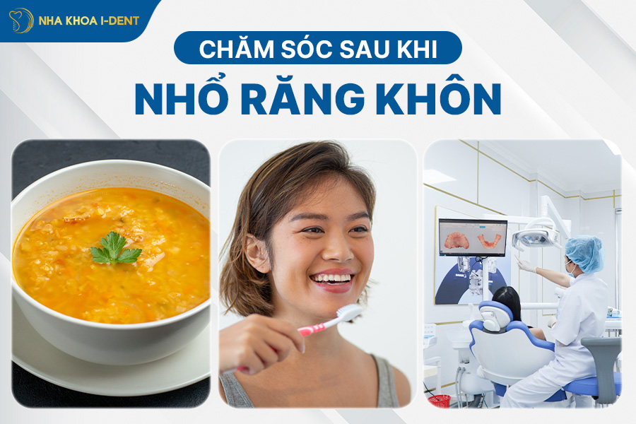 Nên nhổ răng khôn lúc nào