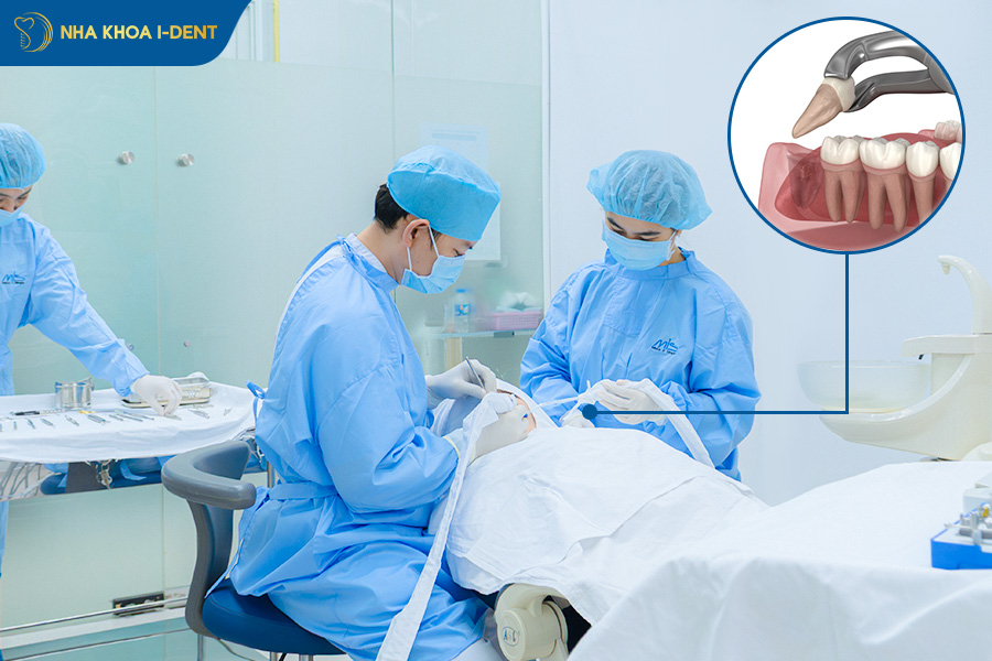 nên nhổ răng khôn ở đâu