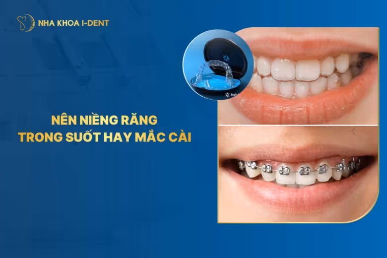 Nên niềng răng trong suốt hay mắc cài? Loại nào tốt?