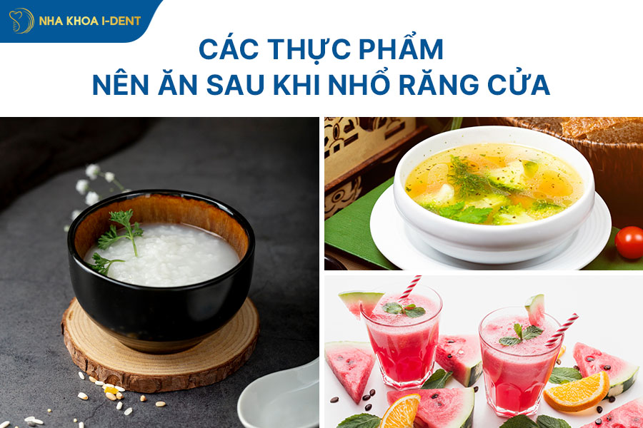nhổ răng cửa bao nhiêu tiền