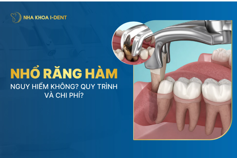 Nhổ răng hàm: Nguy hiểm không? Quy trình và chi phí? 