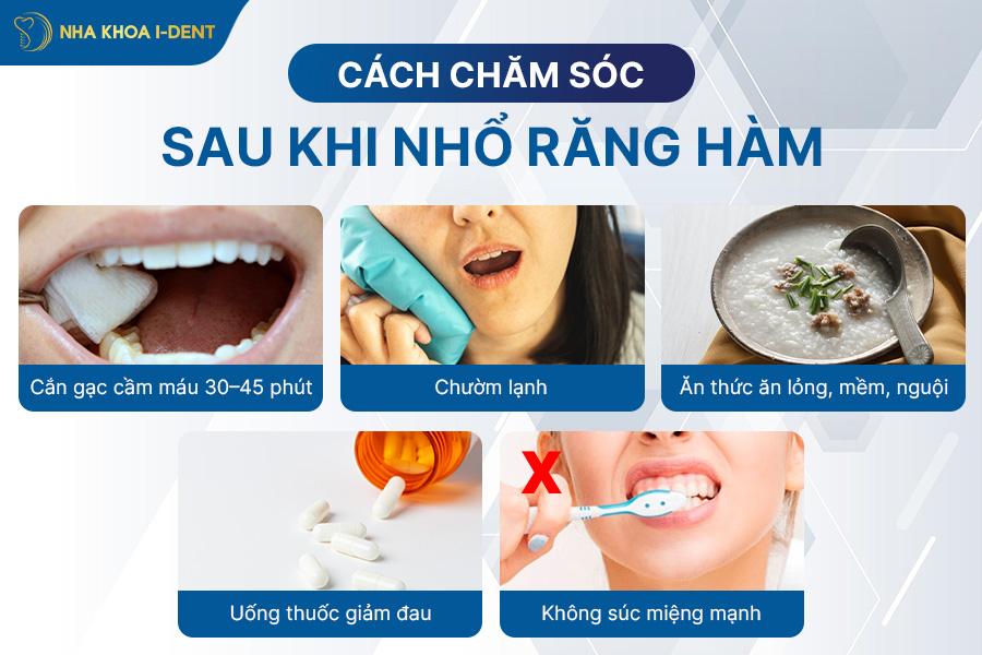 nhổ răng hàm giá