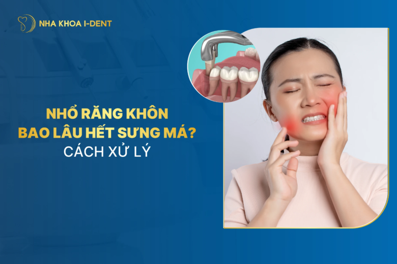Nhổ răng khôn bao lâu hết sưng má? Cách xử lý