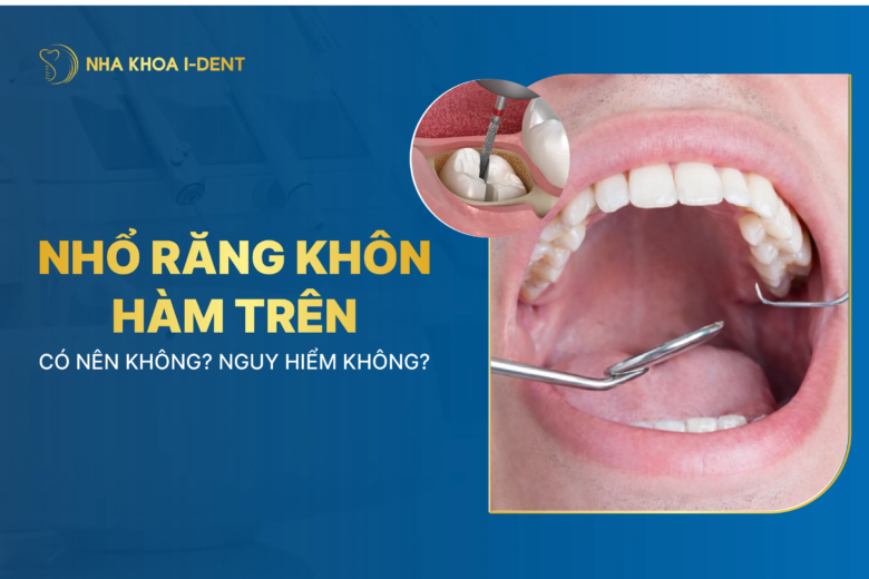 Nhổ răng khôn hàm trên: Có nên không? Nguy hiểm không?