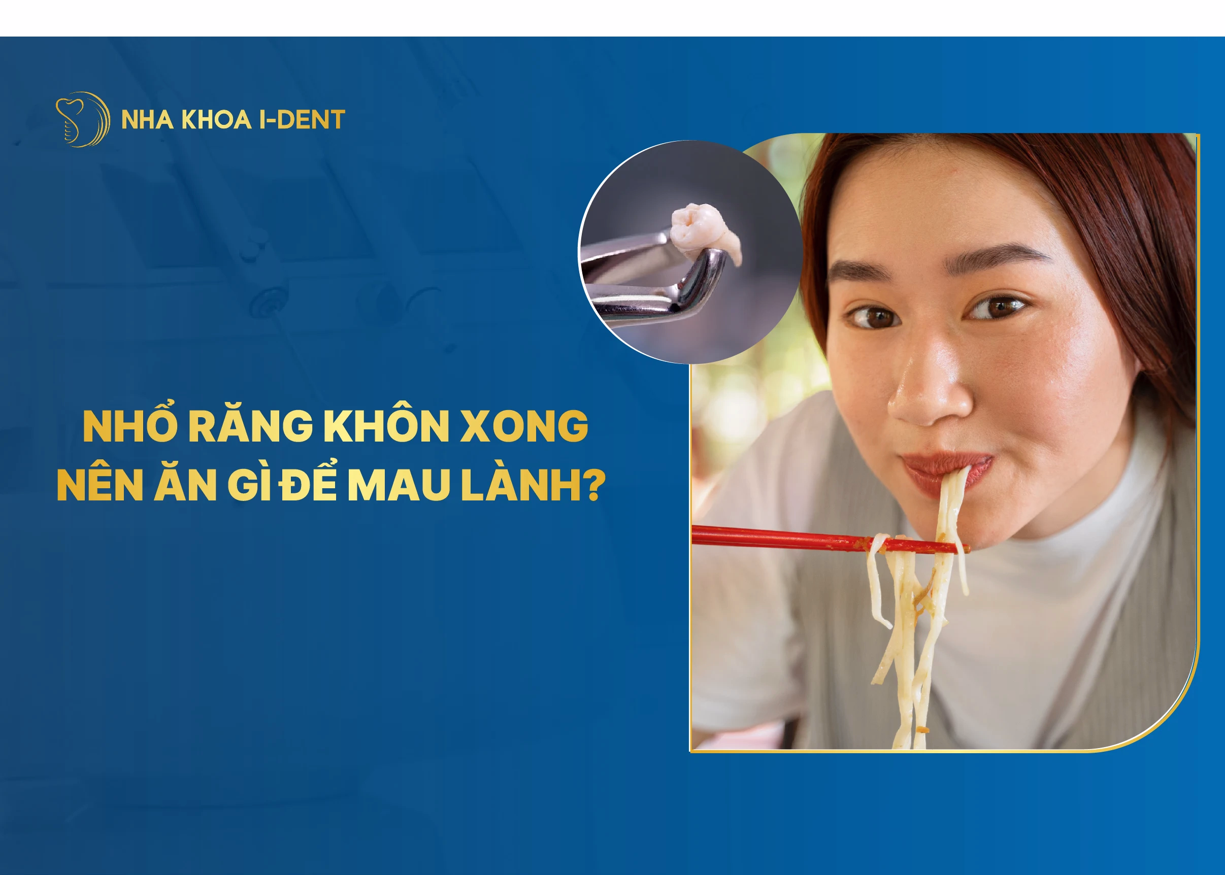 nhổ răng khôn xong nên ăn gì