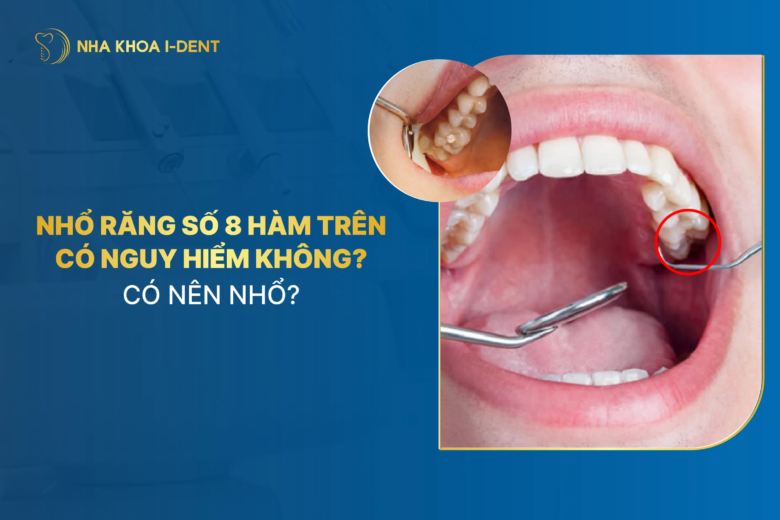 Nhổ răng số 8 hàm trên có nguy hiểm không? Có nên nhổ?