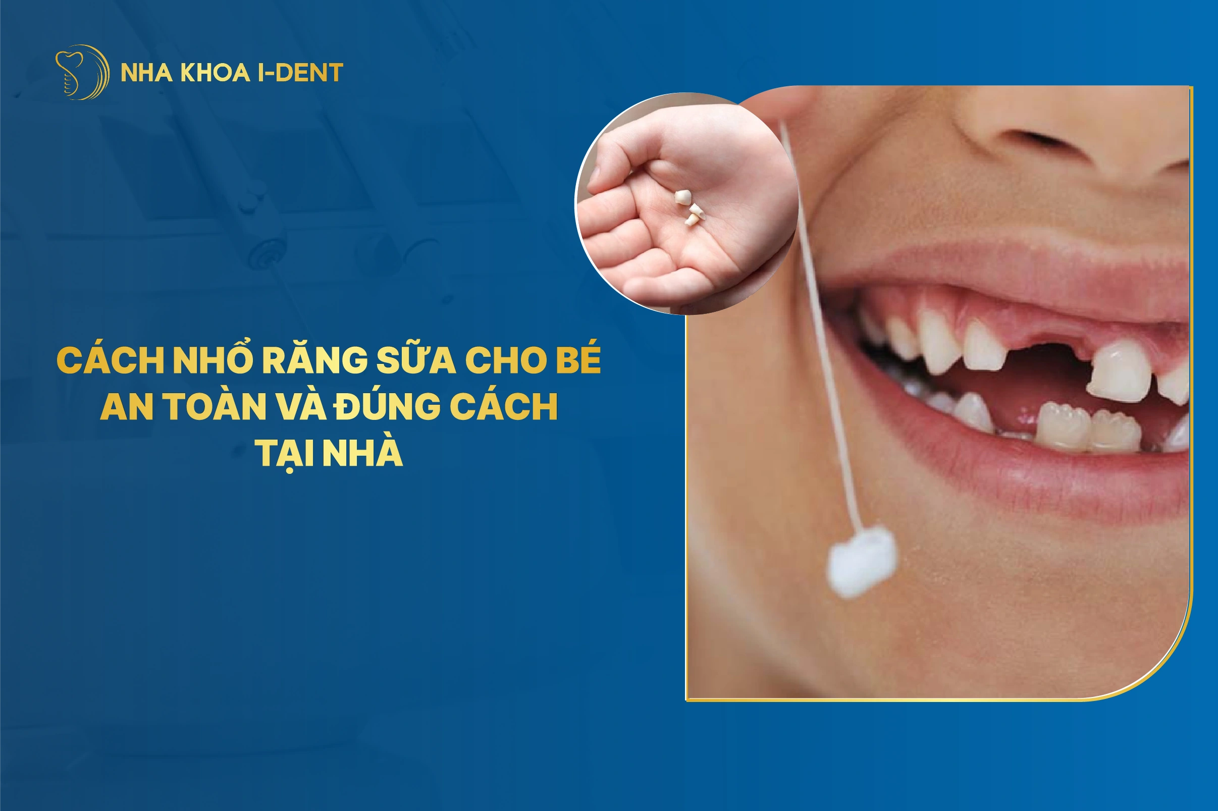 Cách nhổ răng sữa cho bé an toàn và đúng cách tại nhà