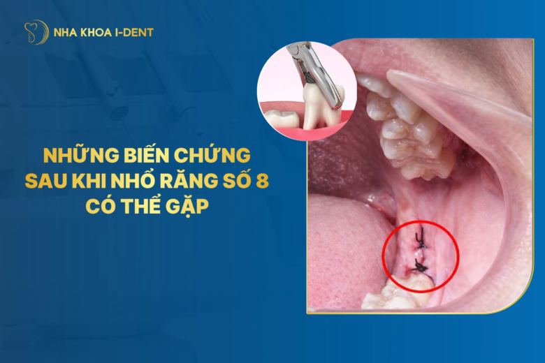 Những biến chứng sau khi nhổ răng số 8 có thể gặp và cách điều trị
