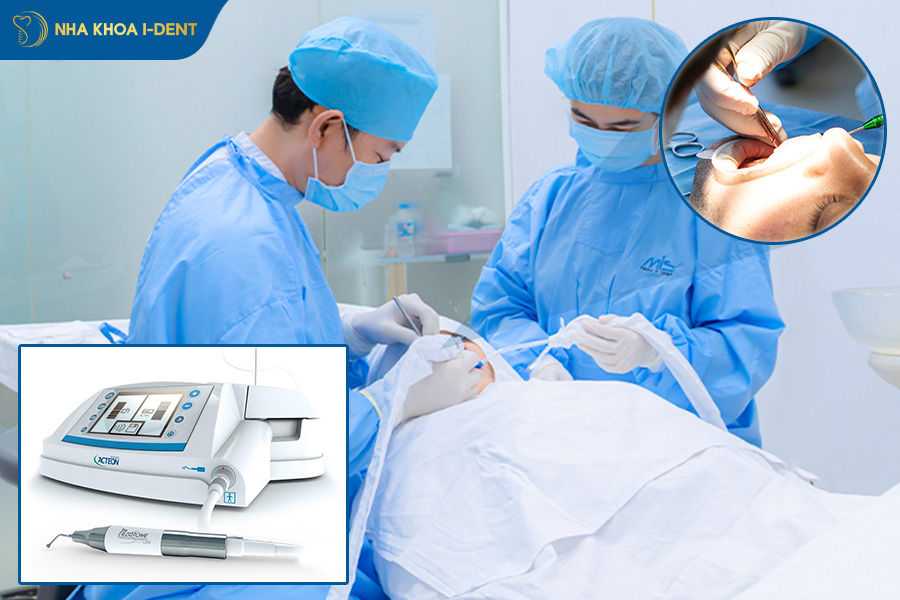 những cách nhổ răng không đau