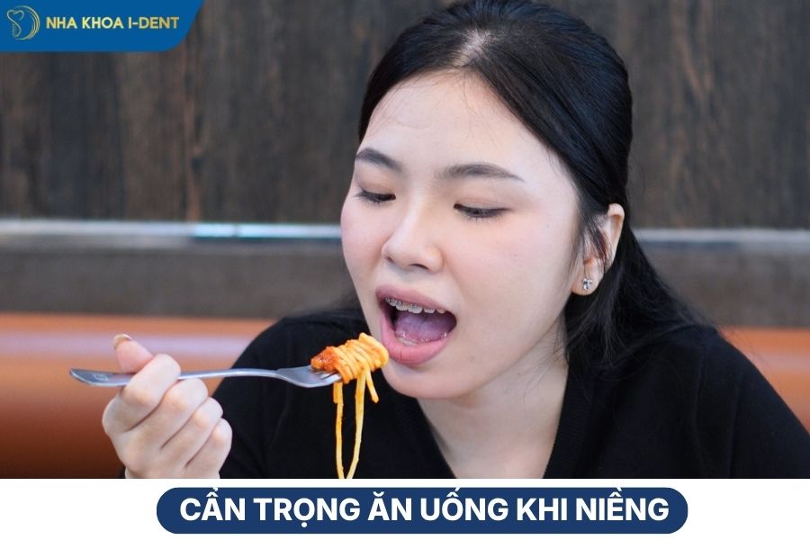 những điều cần biết trong khi niềng răng