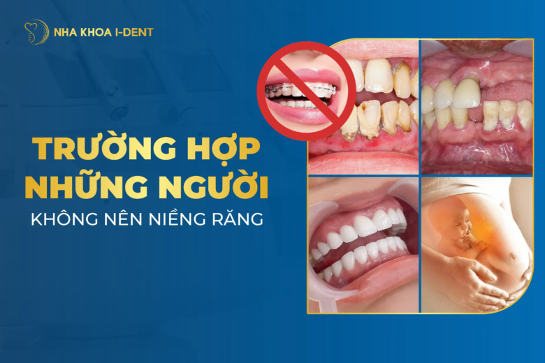 Những Người Không Nên Niềng Răng? Đối Tượng Cần Tránh