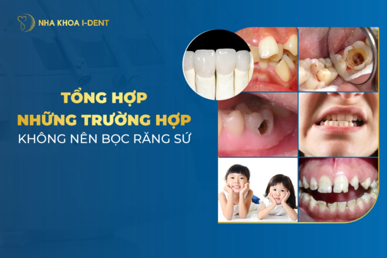 Tổng hợp những trường hợp không nên bọc răng sứ