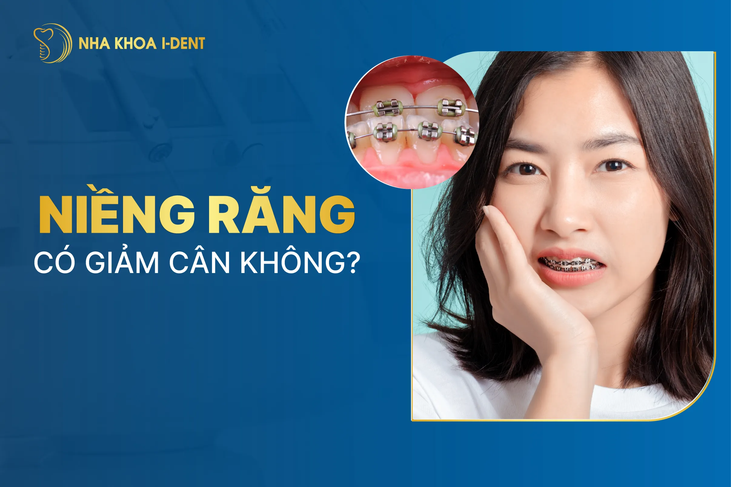 Niềng răng có giảm cân không? Nguyên nhân và cách khắc phục