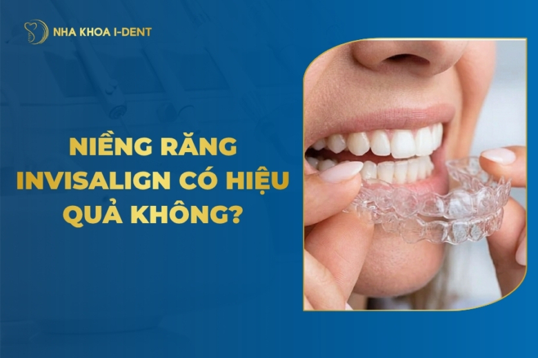 Niềng răng Invisalign có hiệu quả không? Chia sẻ thực tế