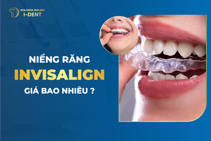 Niềng Răng Invisalign Giá Bao Nhiêu? Bảng Giá Mới Nhất