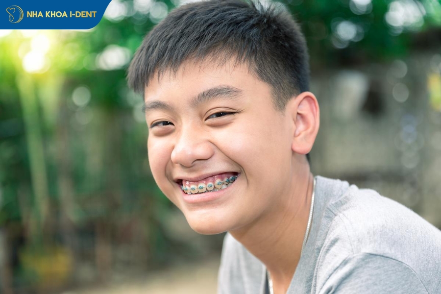 Độ tuổi niềng răng có thể quyết định đến việc bạn niềng răng hay không