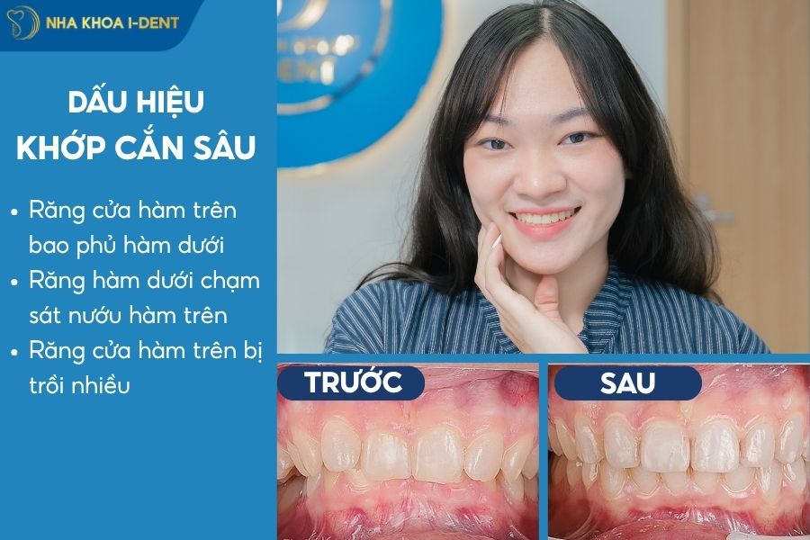 dấu hiệu nhận biết khớp cắn sâu