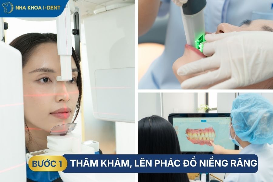 niềng răng khớp cắn sâu bao nhiêu tiền