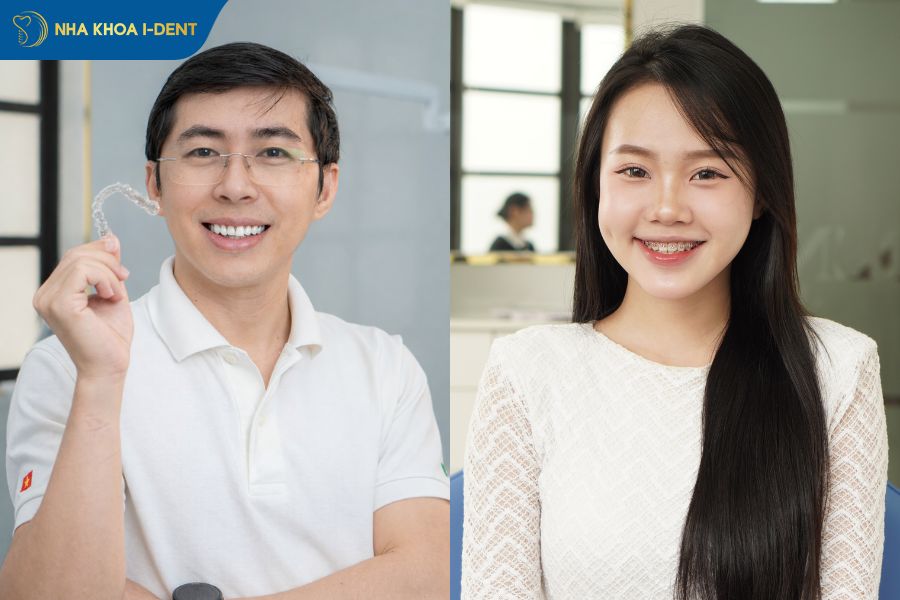 niềng răng loại nào