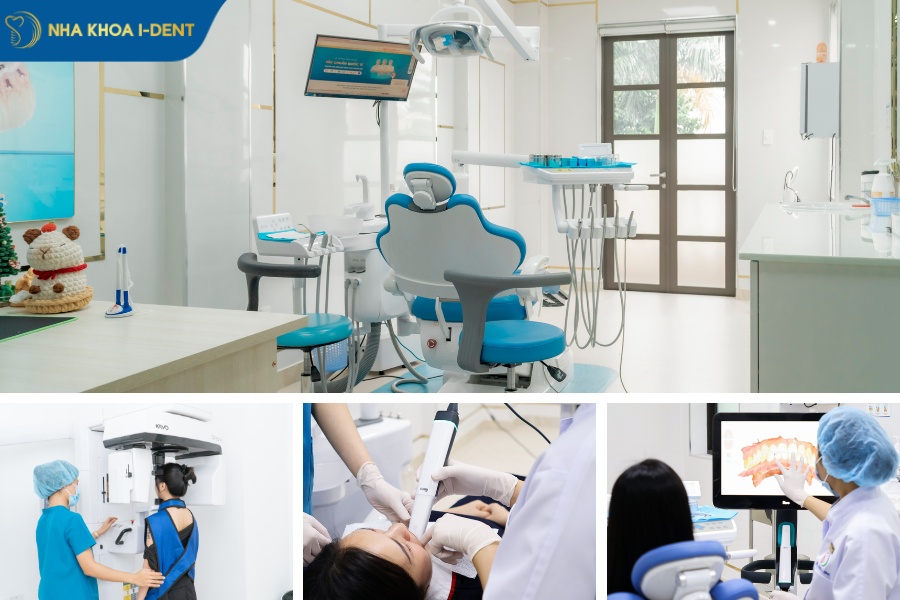 giá niềng răng mắc cài kim loại thường