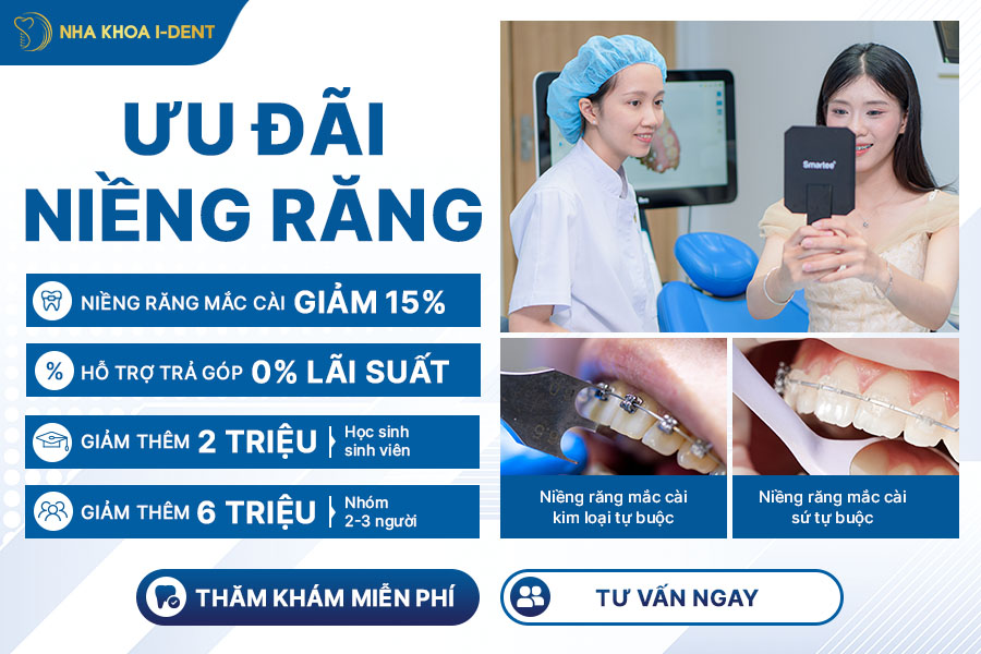niềng răng mắc cài tự buộc